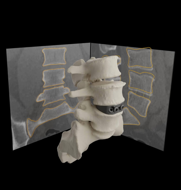 3DMorphic